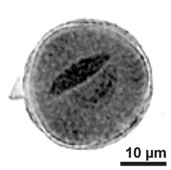 generative cell (left) and vegetative nucleus (right)