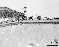 pollen wall at transition of aperture and interapertural area, intine (I), endexine (E)