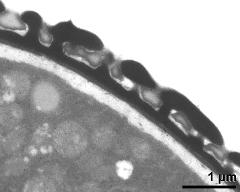 pollen wall, interapertural area