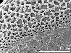 sulcus border