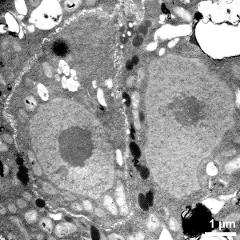 generative cell (left) and vegetative nucleus