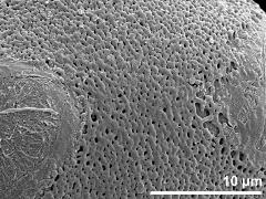 exine surface,polar proximal area