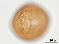 acetolyzed pollen,equatorial view