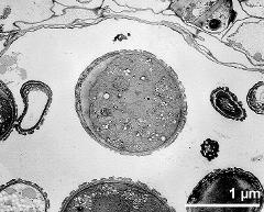 pollen grain in cross section