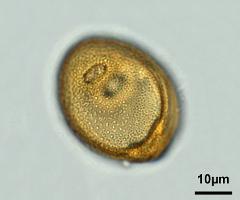 acetolyzed pollen,equatorial view