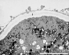 apertural area of pollen wall, intine (I)