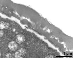 pollen wall, interapertural area