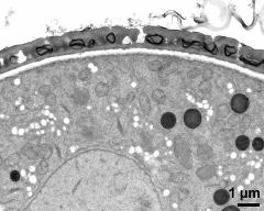 interapertural area of pollen wall