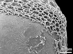 sulcus border (apex)