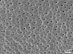 acetolyzed pollen,exine surface