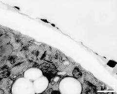 apertural area of pollen wall