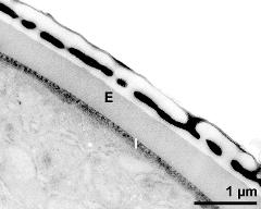 pollen wall, interapertural area