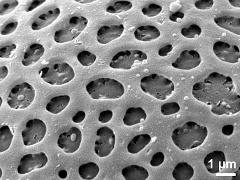 exine surface
