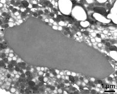 vegetative nucleus