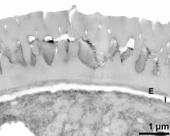 interapertural area of pollen wall, intine (I), endexine (E)