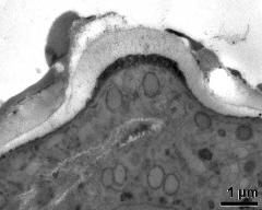 apertural area of pollen wall