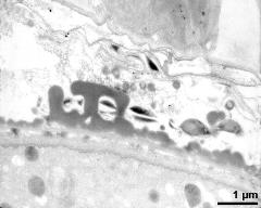 interapertural area of pollen wall