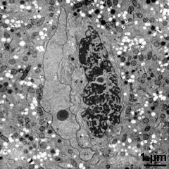 generative cell (right) and vegetative nucleus (left)