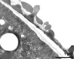 pollen wall at transition of aperture and interapertural area