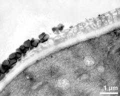 pollen wall at transition of aperture and interapertural area