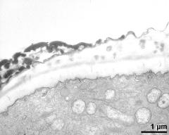 pollen wall at transition of aperture and interapertural area