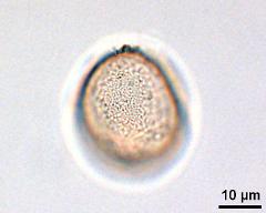 acetolyzed pollen,upper view