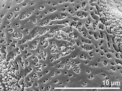 exine surface (equatorial region)