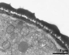 pollen wall, interapertural area