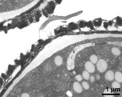 pollen wall, aperture area