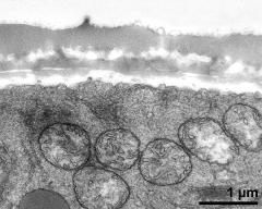 pollen wall, interapertural area