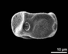 dry pollen grain in equatorial view