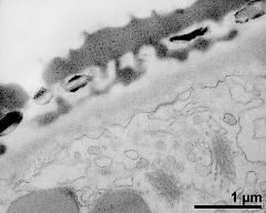 interapertural area of pollen wall