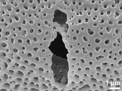 acetolyzed pollen,aperture