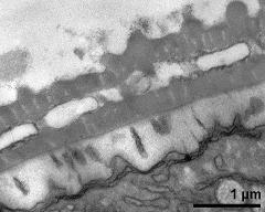 interapertural area of pollen wall