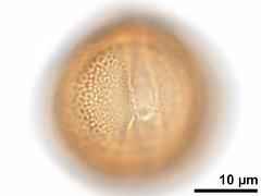 acetolyzed pollen,equatorial view