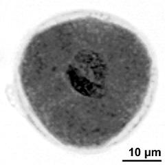 generative cell (dark stained, bottom) and vegetative nucleus (top)