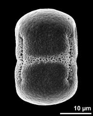 dry pollen grain in equatorial view