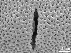 acetolyzed pollen,aperture