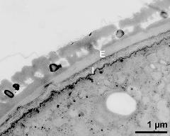 interapertural area of pollen wall, intine (I), endexine (E)