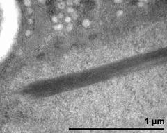 detail of crystalline inclusions (protein bodies) in the vegetative nucleus