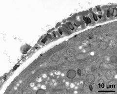 pollen wall at transition of aperture and interapertural area