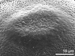 exine surface,interapertural area,equator