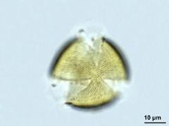 acetolyzed pollen,polar view