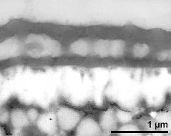 interapertural area of pollen wall