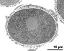 cross section of pollen grain