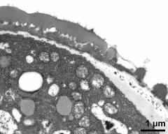 pollen wall, aperture area