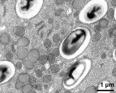 vegetative cytoplasm with organells