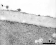 apertural area of pollen wall