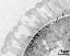 interapertural area of pollen wall, intine (I), endexine (E)