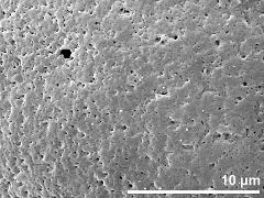 exine surface (saccus)